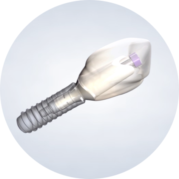 homepage-proceduredental-implant